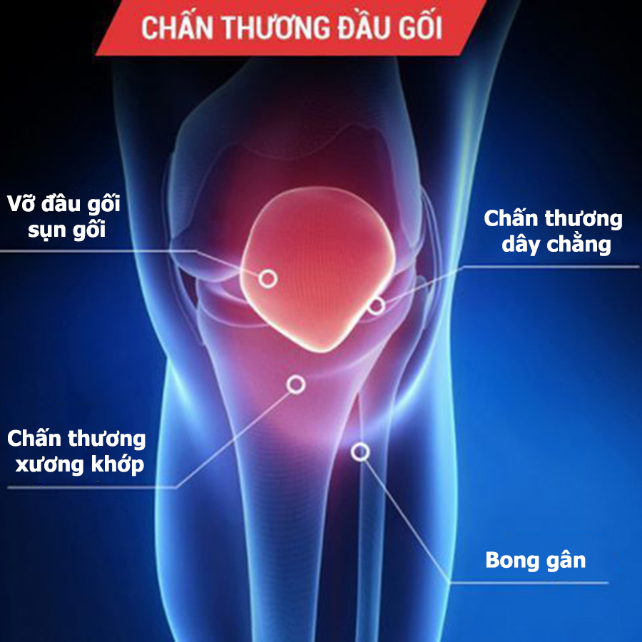 băng chống chấn thương đầu gối, băng chống chấn thương khớp gối, băng bảo vệ gối tránh chấn thương, băng gối chống chấn thương chạy bộ, băng đai bảo vệ khớp gối, băng hỗ trợ đứt dây chằng, băng bó đầu gối, băng bó khớp gối, băng đeo đầu gối